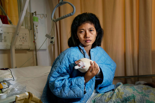 Anis had her ring finger tendon sliced and her bone fractured with a butcher's knife by her Hong Kong employer - Steve McCurry